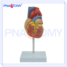 Modèle de coeur humain en plastique d&#39;athérosclérose de PNT-0400 pour l&#39;enseignement médical